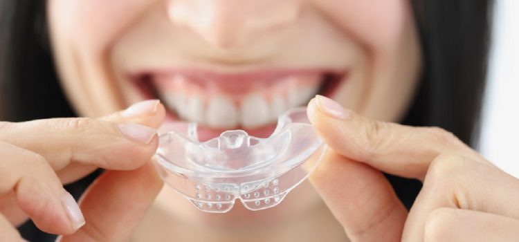 Jak sprawić, by aparat ortodontyczny nie był widoczny dla innych osób?